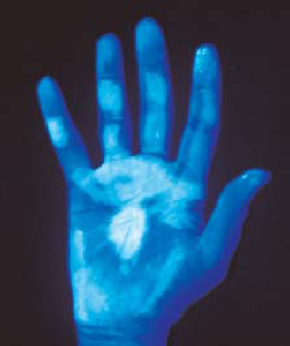 UV Handkontrolle Beispiel ungenügend desinfiziert